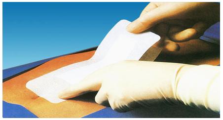 胃癌手术后如何预防切口感染